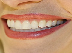 Affordable Orthodontic Treatment in Medellin